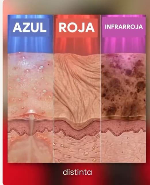 Diagrama comparativo de penetración en la piel de luz azul, roja e infrarroja